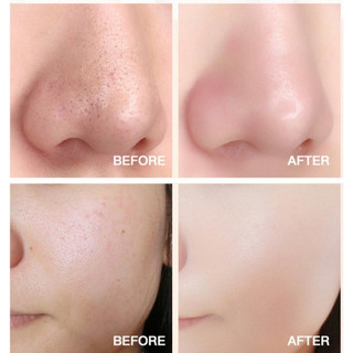 Mặt Nạ Sủi Bọt Thải Độc Cà Rốt  12 Gói