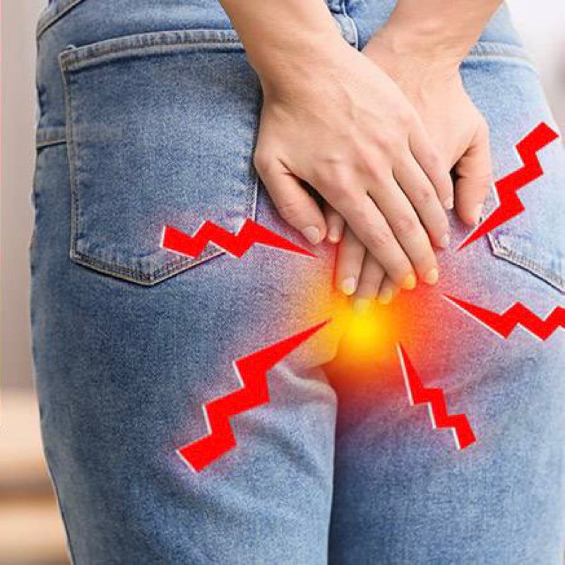 Kem bôi trĩ Preparation H Hemorrhoidal fast cooling relief gel chuẩn Mỹ 26g Date 3/25