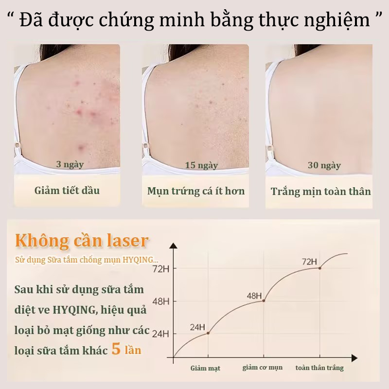 sữa tắm trắng da sữa tắm mụn lưng sữa tắm lưu hương 500ml Làm sạch sâu làm trắng dưỡng ẩm loại bỏ mụn trứng cá