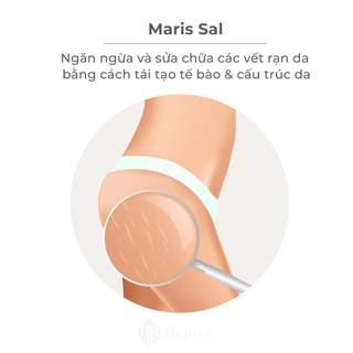 Kem rạn da Rejuve Corporal Stretch Marks (120ml)