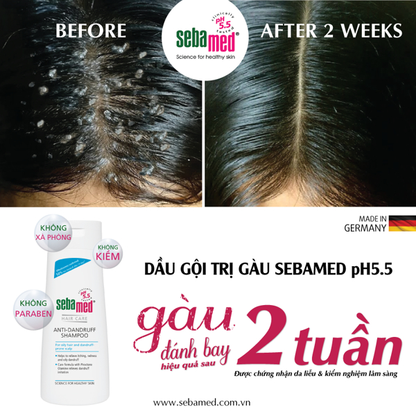 Dầu gội giúp giảm gàu Sebamed Hair Care Anti-Dandruff Shampoo pH5.5 (200ml)