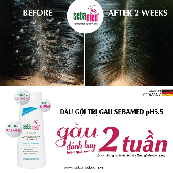 Dầu gội giúp giảm gàu Sebamed Hair Care Anti-Dandruff Shampoo pH5.5