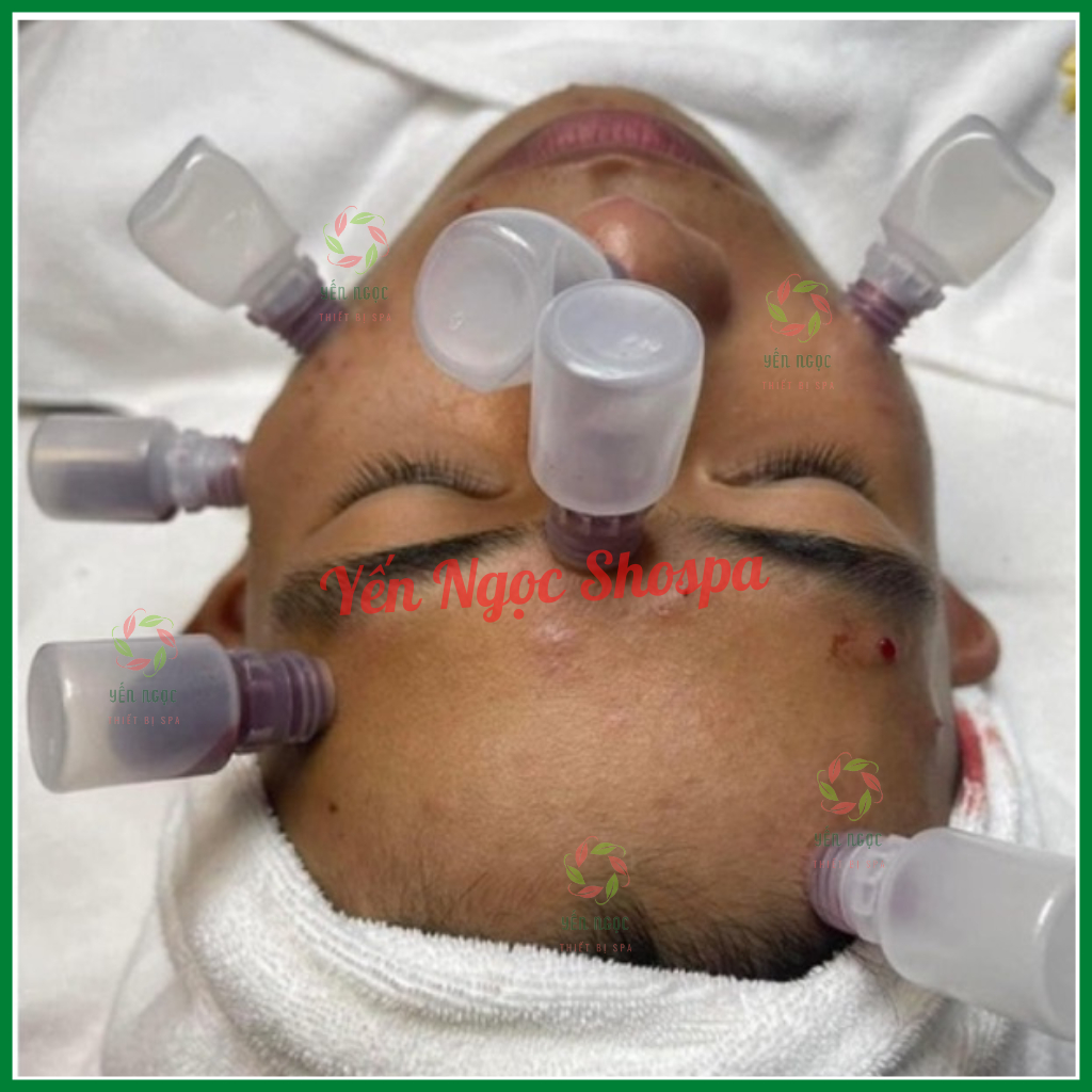 Combo 10 ống nhựa hút máu bầm, hút mụn