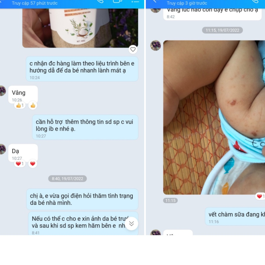 Kem Chống Hăm Em Bé Bon Bon  An Toàn Cho Bé - Giảm Ngay Hăm Ngứa , Rôm Sảy Trên Da Bé
