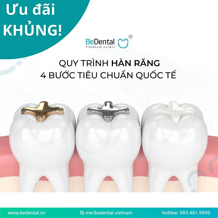 Evoucher Hàn răng/Trám răng - Nha khoa BeDental - Áp dụng 5 chi nhánh