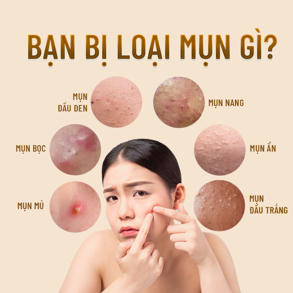 Kem Giảm Mụn Mù U - Tamanu Cream Dr.Luvis Thông Thoáng Lỗ Chân Lông 10gr