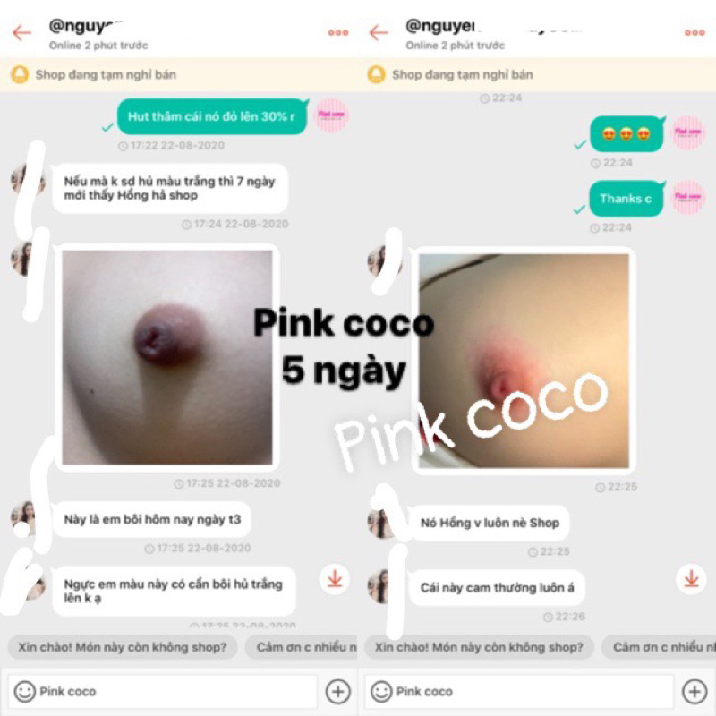 Kem làm hồng nhũ hoa Pink coco