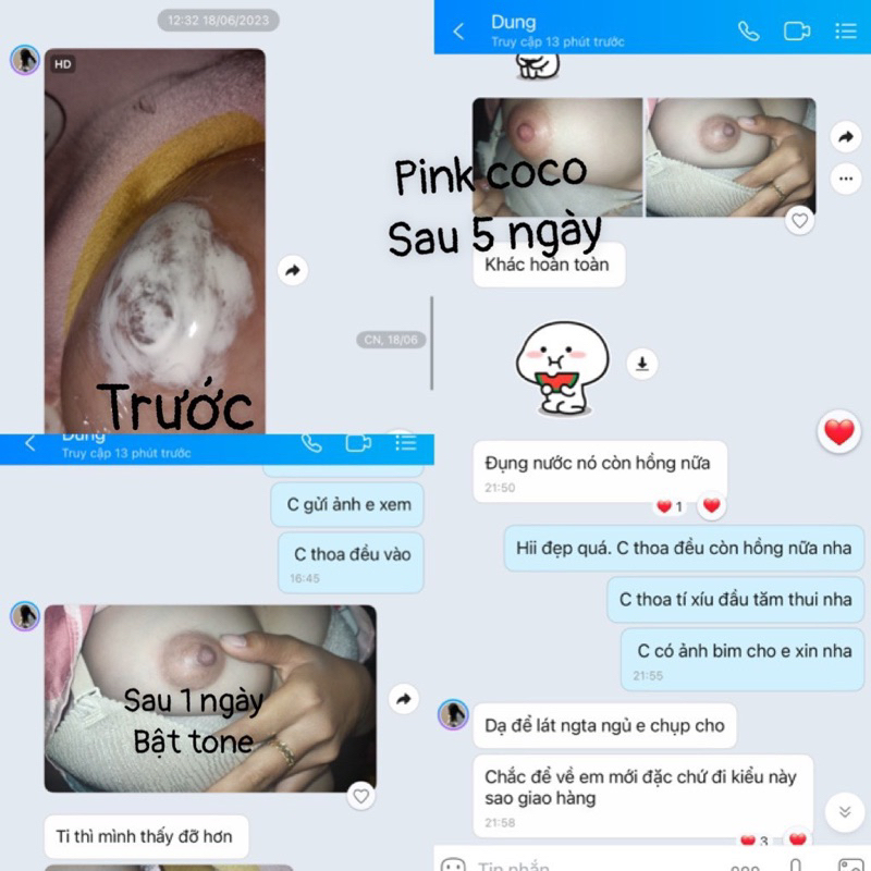 Kem làm hồng nhũ hoa PINK COCO mẫu mới
