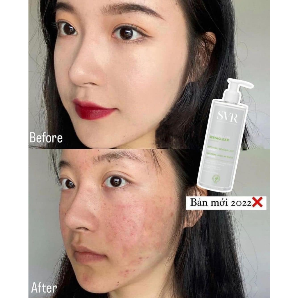 Nước Tẩy Trang SVR Sebiaclear Eau Micellaire Cho Da Dầu Mụn, Nhạy Cảm 400ml