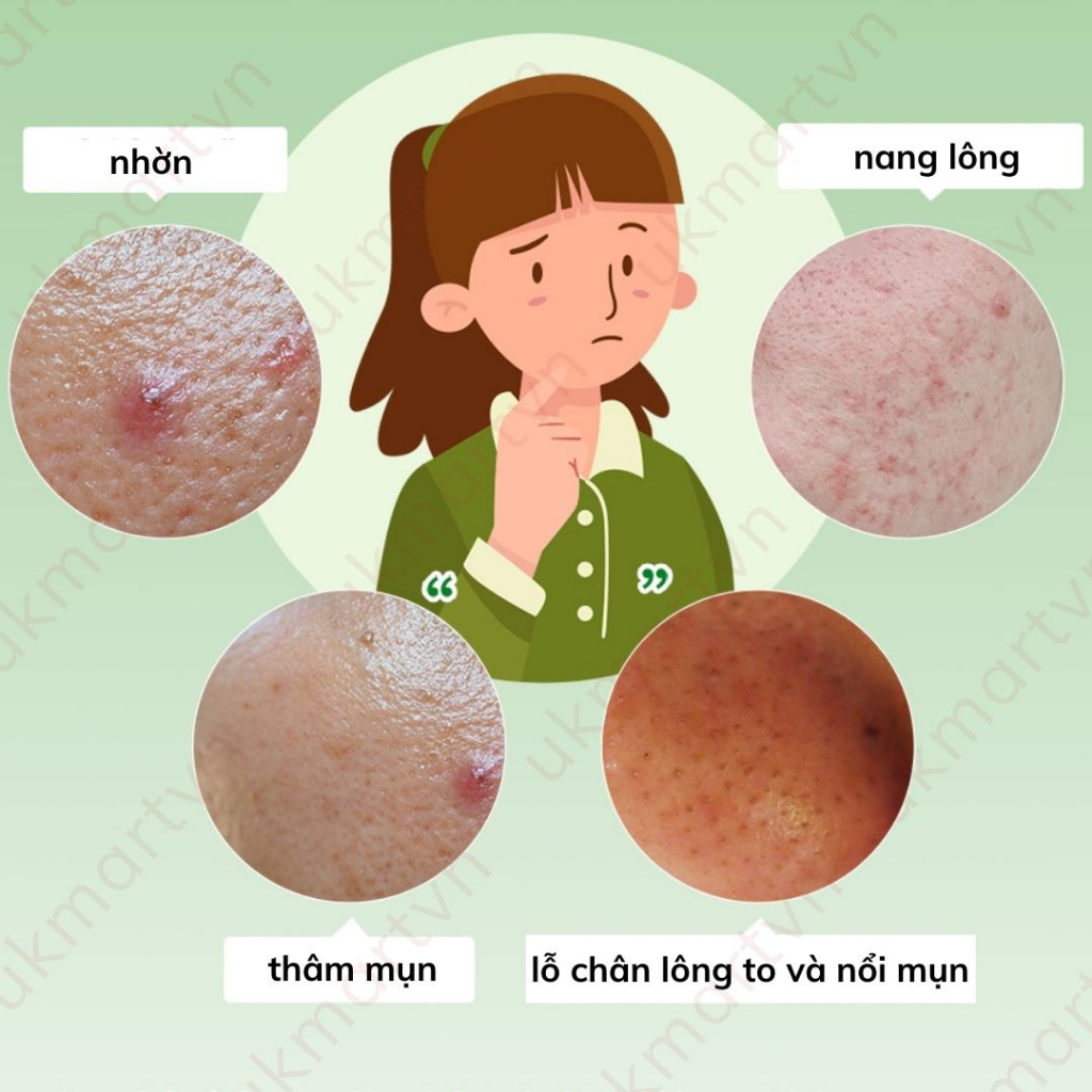 Nước Tẩy Trang Dạng Bọt Naruko Tràm Trà Tea Tree Blemish Clear Makeup Removing Cleansing Mousse 150 ml