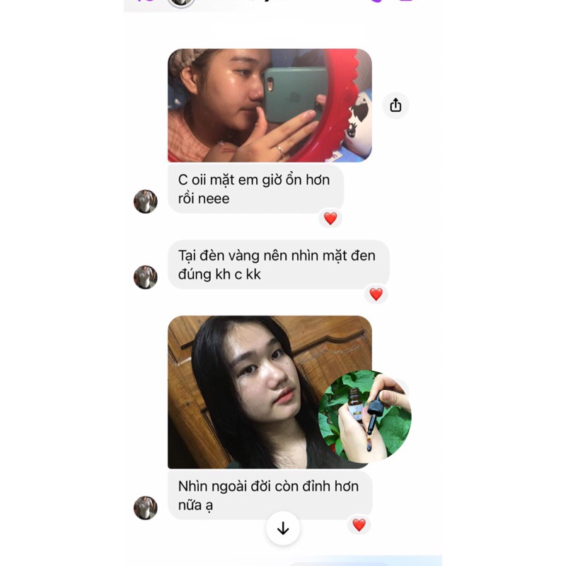 Serum mụn ACNES TREATMENT gom cồi mụn