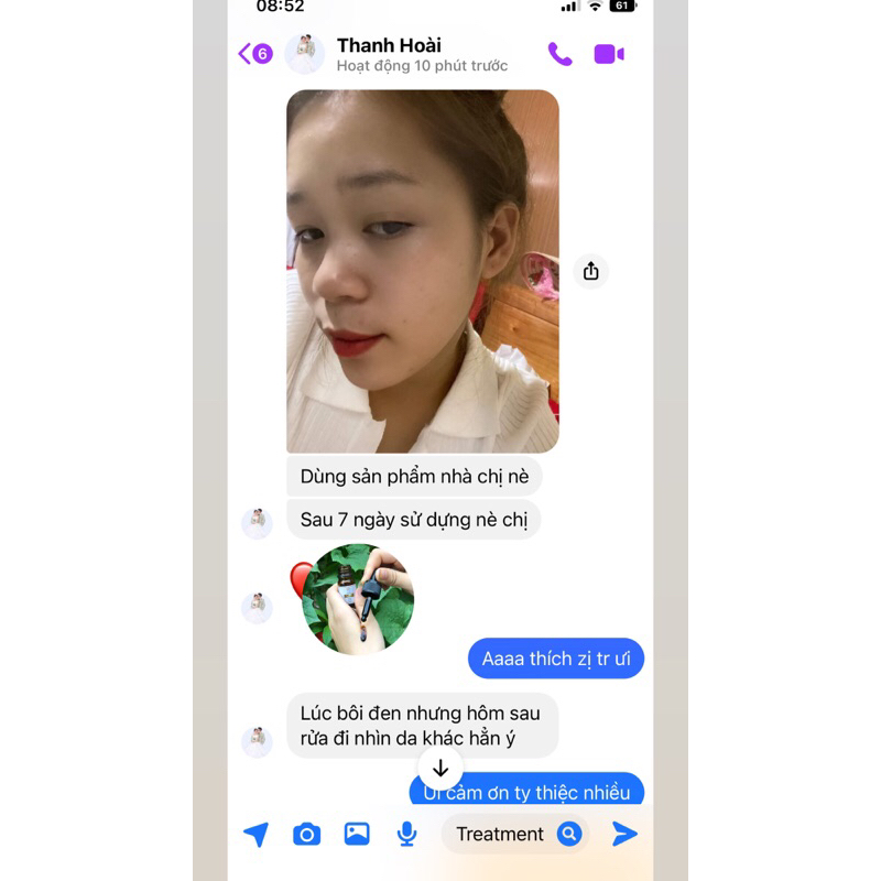 Serum mụn ACNES TREATMENT gom cồi mụn