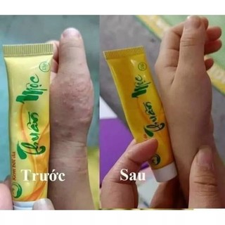 [Chính Hãng ] COMBO 5 TUÝP KEM BÔI DA THUẦN MỘC []