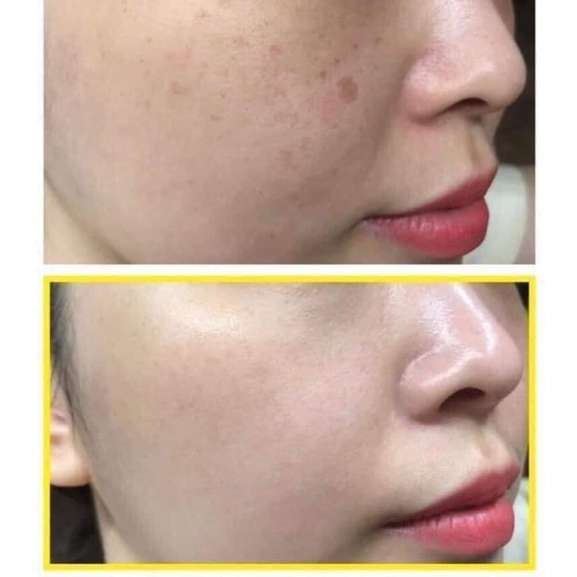 Hộp Viên Uống Giảm Nám Transino Whitening - Hộp Trắng