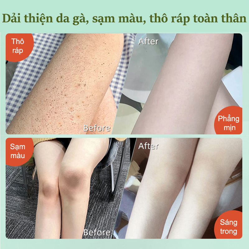 Kem tẩy tế bào chết cơ thể Tẩy tế bào chết  body da mặt 250G Loại bỏ nổi da gà và da xỉn màu