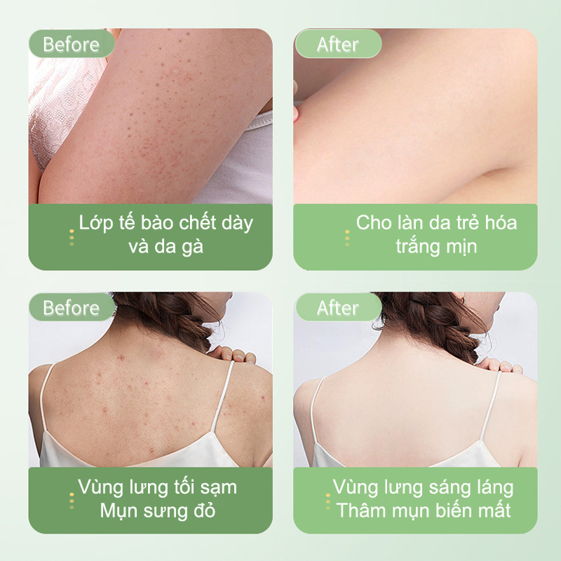 Kem tẩy tế bào chết cơ thể Tẩy tế bào chết  body da mặt 250G Loại bỏ nổi da gà và da xỉn màu