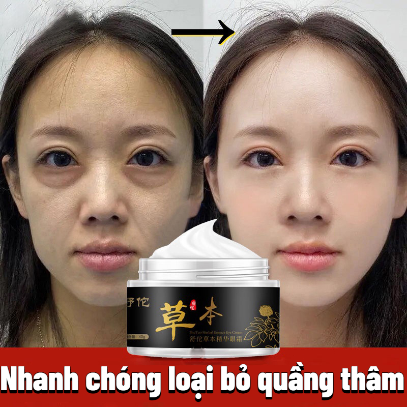 Kem mắt Tinh chất mắt Loại bỏ nhanh chóng quầng thâm giảm bọng mắt các hạt chất béo chống nhăn Kem mắt thảo dược dưỡng