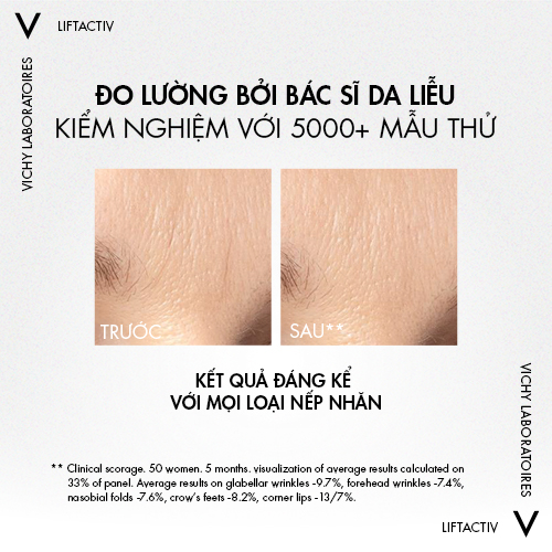 Dưỡng chất giảm nếp nhăn và giúp da trông trẻ hơn Vichy Liftactiv Retinol 30ml