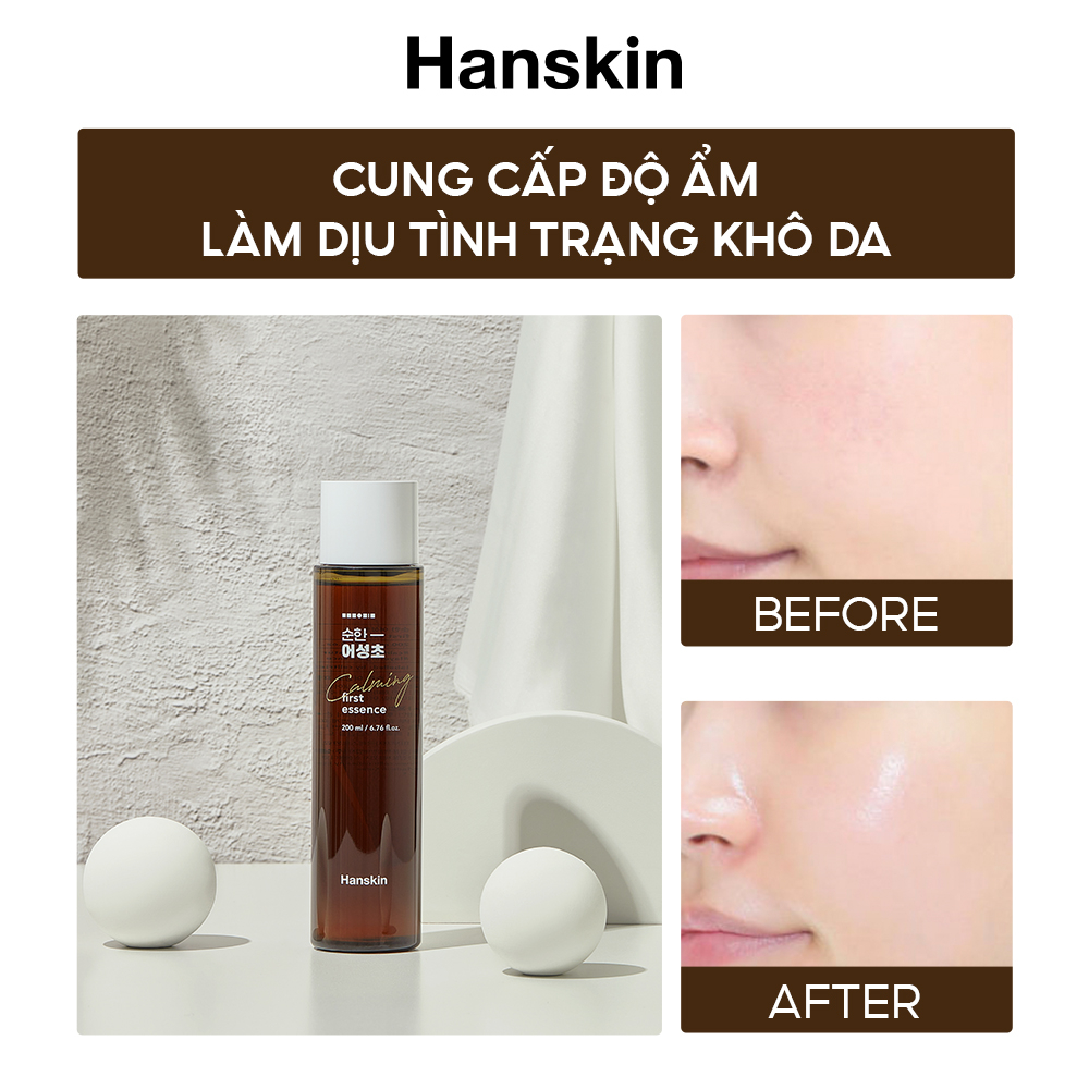 [Mã BMLTB35 giảm đến 35K đơn 99K] Nước Dưỡng Da Cấp Ẩm, Chống Lão Hóa HANSKIN SOONHAN HOUTTUYNIA FIRST ESSENCE 200ml