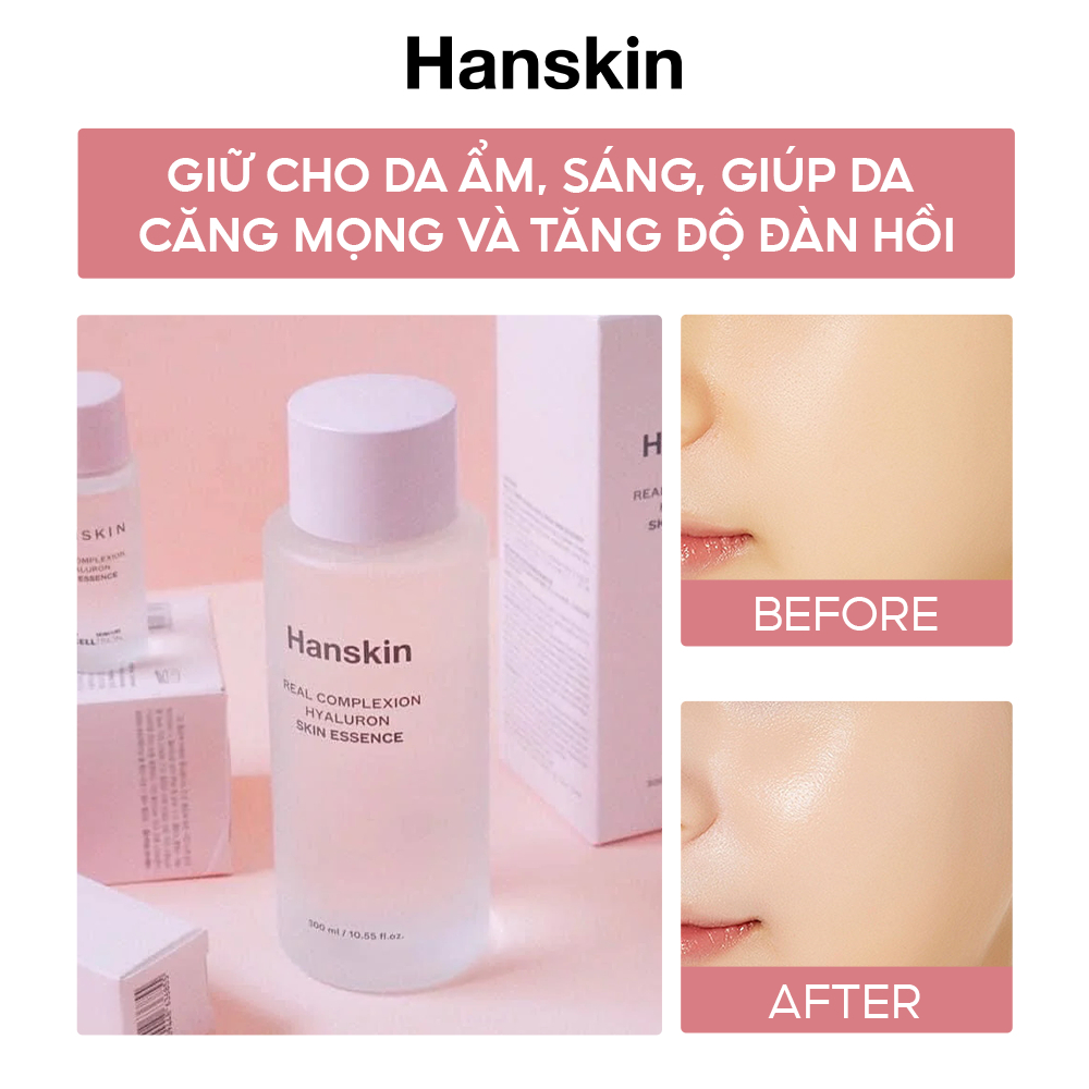 Nước Hoa Hồng Dưỡng Ẩm HANSKIN REAL COMPLEXION HYALURON SKIN ESSENCE 300ml/150ml