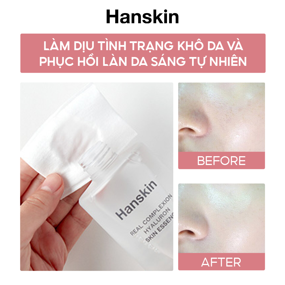 Nước Hoa Hồng Dưỡng Ẩm HANSKIN REAL COMPLEXION HYALURON SKIN ESSENCE 300ml/150ml