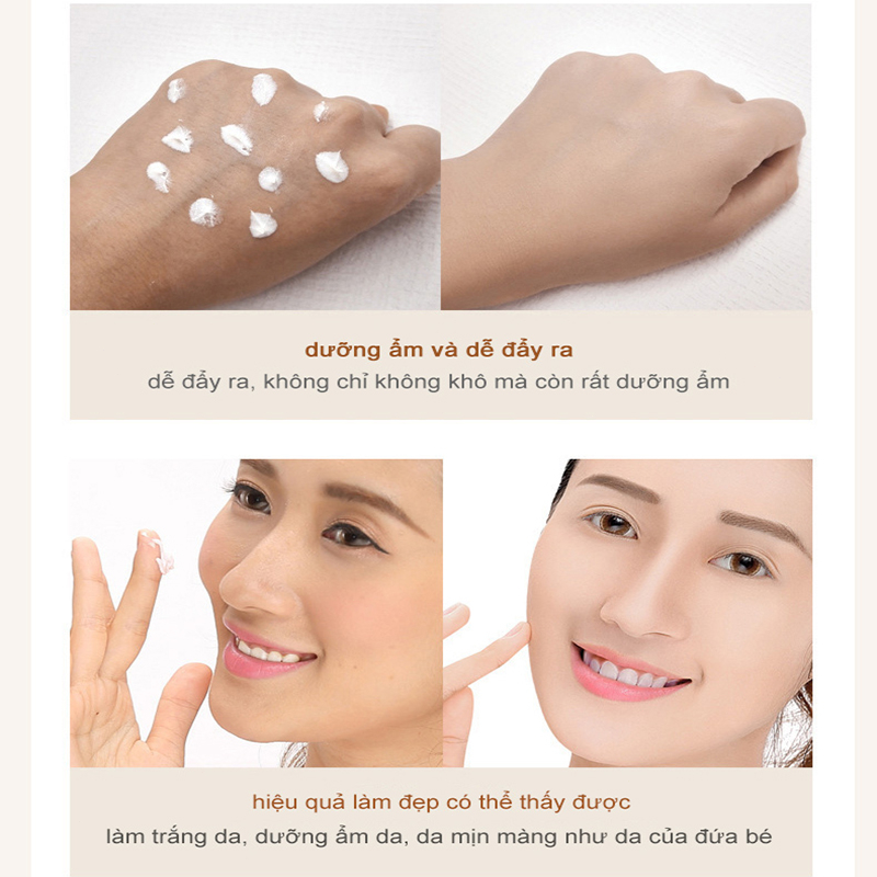 Kem nám tàn nhang kem tàn nhang kem dưỡng trắng da 30g dưỡng trắng Làm sáng tông da tức thì