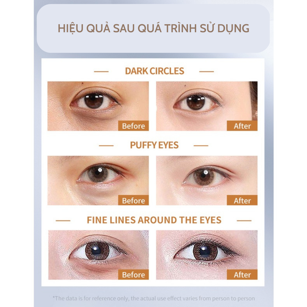 Kem dưỡng mắt giúp phục hồi da mắt, Serum mắt Deleventh Caffeine Ceramide, giảm quầng thâm và bọng mắt (30ml )