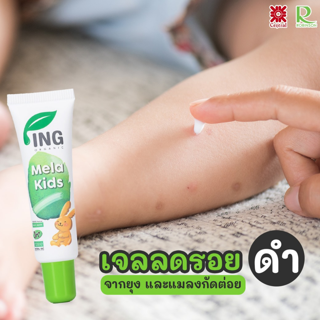 SERUM MELA KIDS LÀM MỜ SẸO THÂM, SẸO DO MUỖI ĐỐT, SẸO DO MỤN THÂM, CÁC VẾT THÂM KHÁC