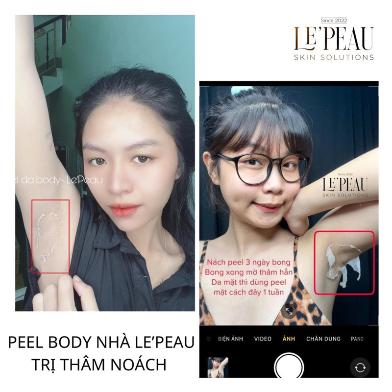 Peel Body Retinol LE'PEAU trắng da mờ thâm sau 7 ngày, loại bỏ tế bào chết cơ thể 50ml