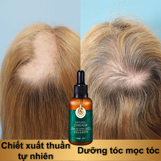 Tinh chất mọc tóc tinh dầu mọc tóc 30ml serum kích mọc tóc chăm sóc tóc chống rụng tóc,kích thích tóc mọc dà