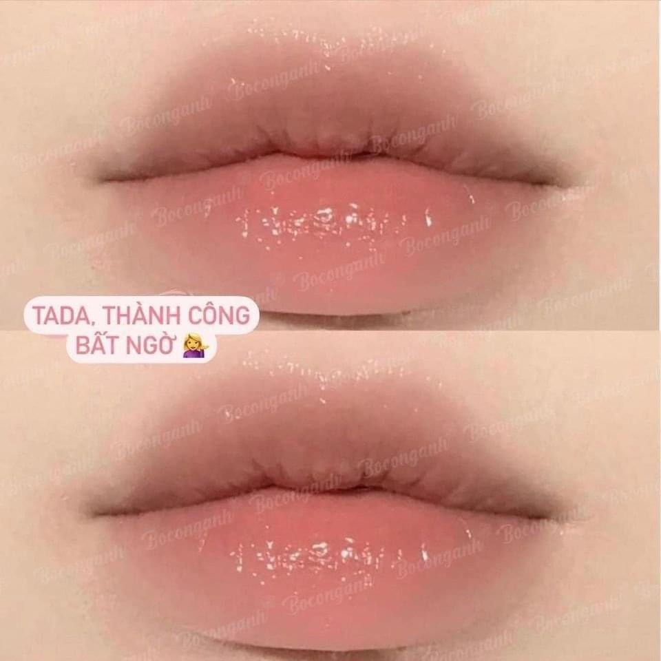 Son dưỡng môi Mediheal Labocare Panteno lips