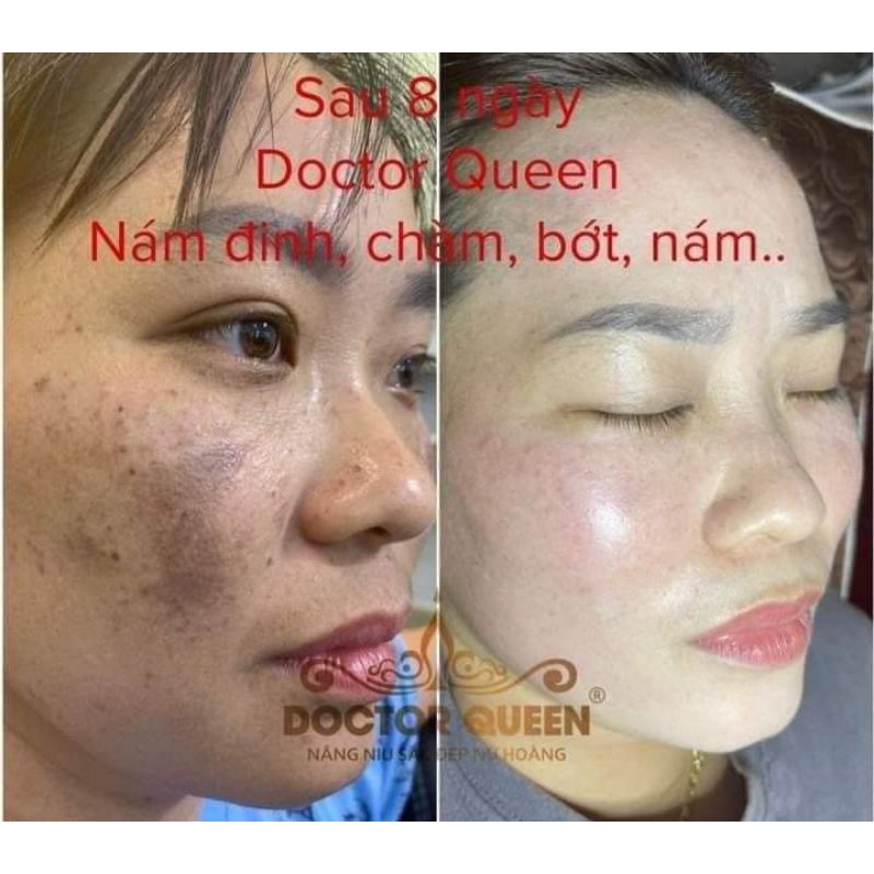 Tinh chất ức chế nám số 2 doctor queen