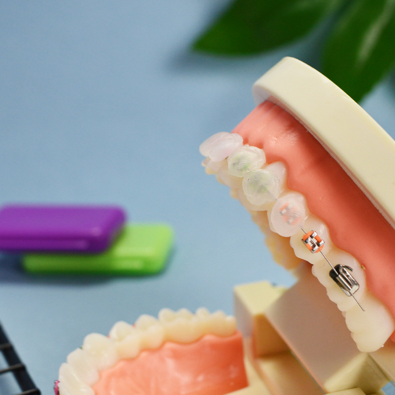 Sáp nha khoa , sáp giảm đau, không mùi cho người niềng răng chỉnh nha DN31