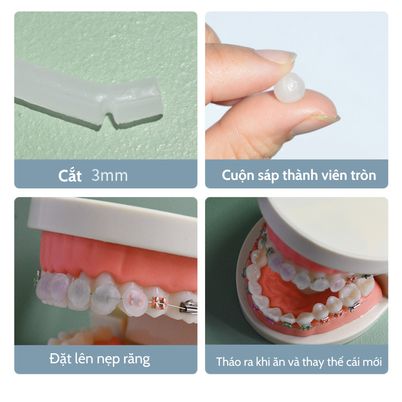 Sáp nha khoa , sáp giảm đau, không mùi cho người niềng răng chỉnh nha DN31