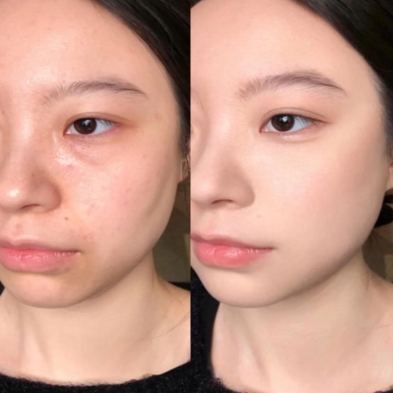 Che Khuyết Điểm Cle De Peau