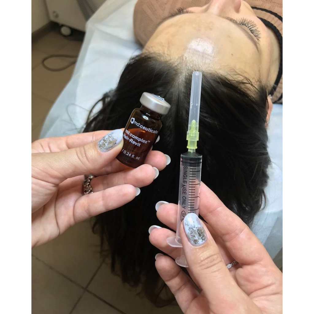 Md:Ceuticals Md Complex Hair-Revit Hoạt Chất giúp mọc tóc và ngăn rụng tóc, phục hồi tóc hư tổn