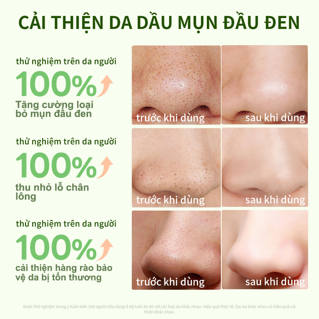AISASEA Mặt nạ giảm mụn đầu đen/trắng làm sạch sâu  Cây chè Serum