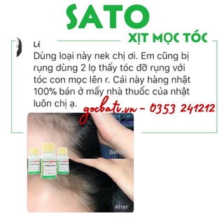 SATO KO RỤNG TÓC