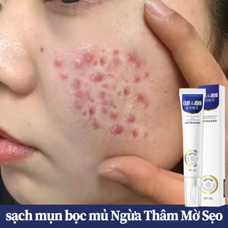 Kem Mụn Kem dưỡng da Giảm xóa sạch mụn bọc mủ trứng cá Ngừa Thâm Mờ Sẹo Trắng sáng Da thông thoáng lỗ chân lông