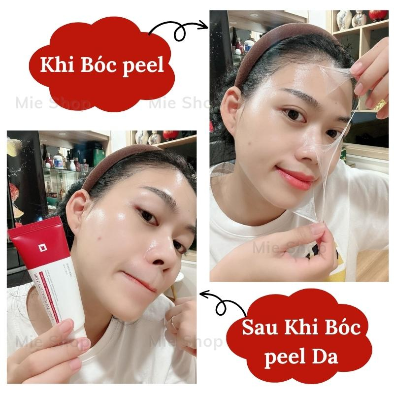Peel da , peel real collagen fit ,dưỡng trắng, mờ thâm. sạm nám ,se khít lỗ chân lông ,trẻ hóa căng bóng da ,mieshop1803