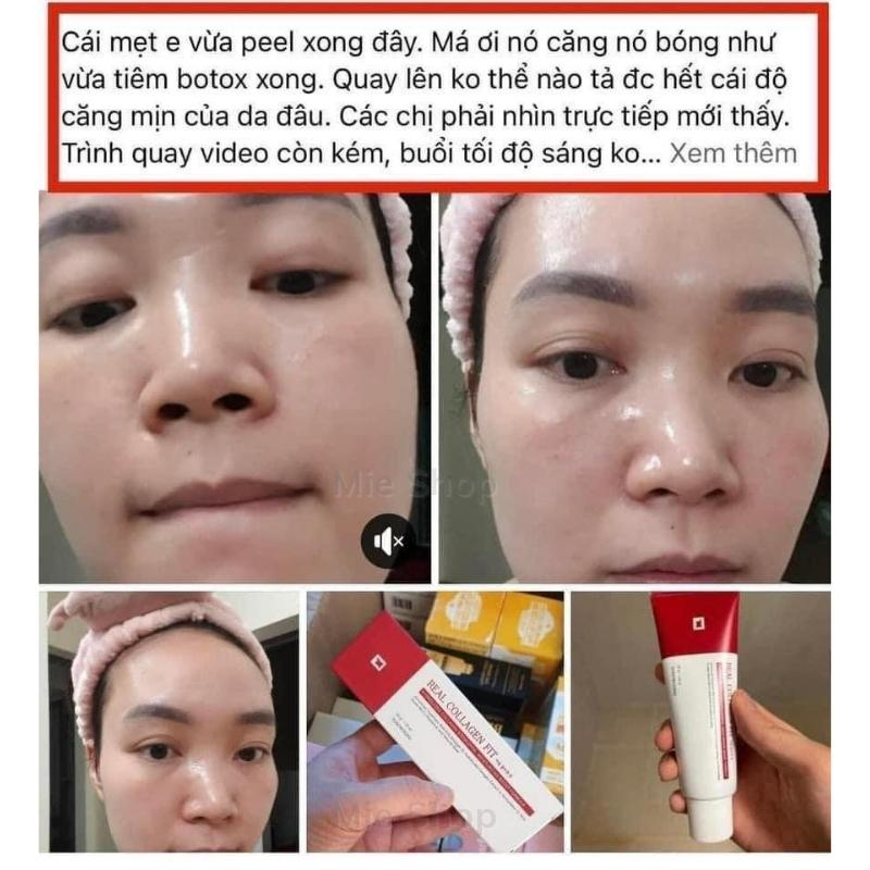 Peel da , peel real collagen fit ,dưỡng trắng, mờ thâm. sạm nám ,se khít lỗ chân lông ,trẻ hóa căng bóng da ,mieshop1803