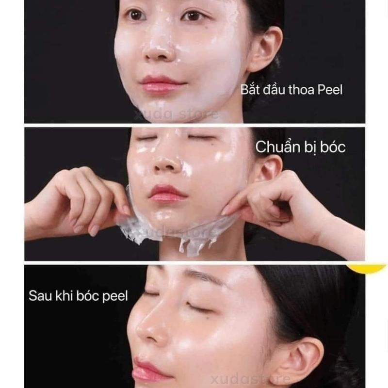 Peel da , peel real collagen fit ,dưỡng trắng, mờ thâm. sạm nám ,se khít lỗ chân lông ,trẻ hóa căng bóng da ,xudastore