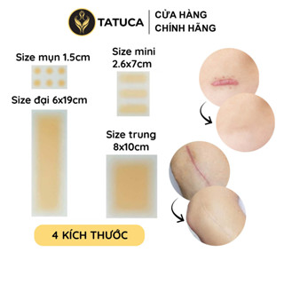 Miếng dán che khuyết điểm che sẹo lồi sẹo lõm sẹo thâm tiệp màu da TATUCA 4 kích thước A1001