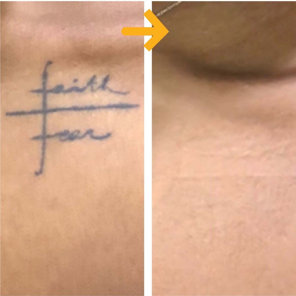 Miếng dán che hình xăm đậm màu TATUCA 3 màu da A1003