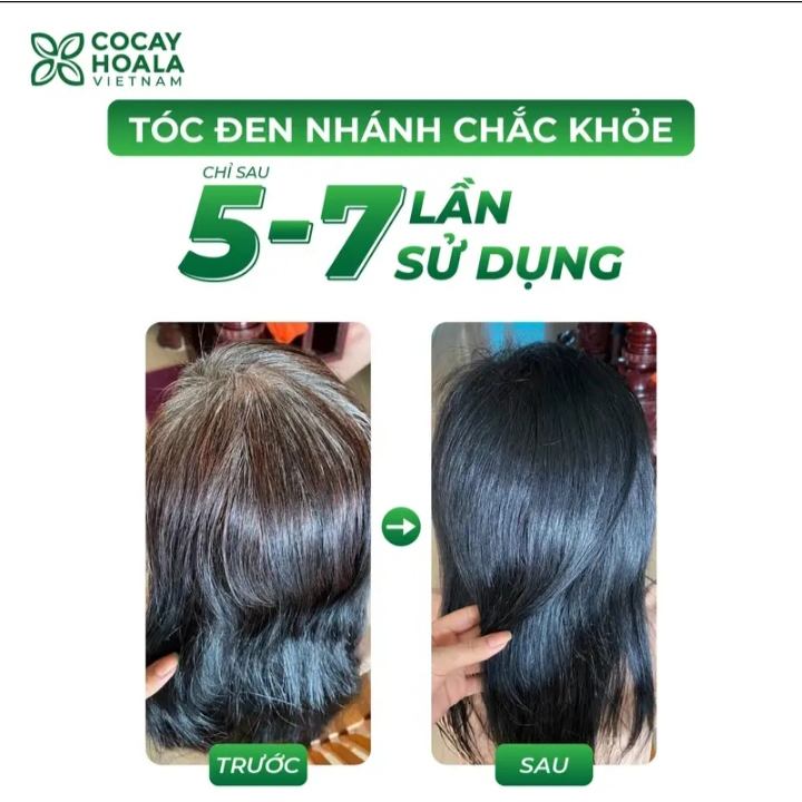 [450ml] Dầu gội hà thủ ô Cỏ Cây Hoa Lá chính hãng làm đen tóc chậm quá trình lão hoá tóc