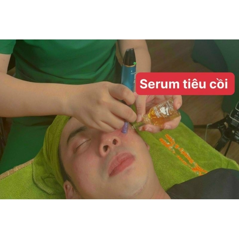 SERUM TIÊU CỒI MỤN GIẢI QUYẾT CÁC LOẠI MỤN CHUYÊN DỤNG SPA