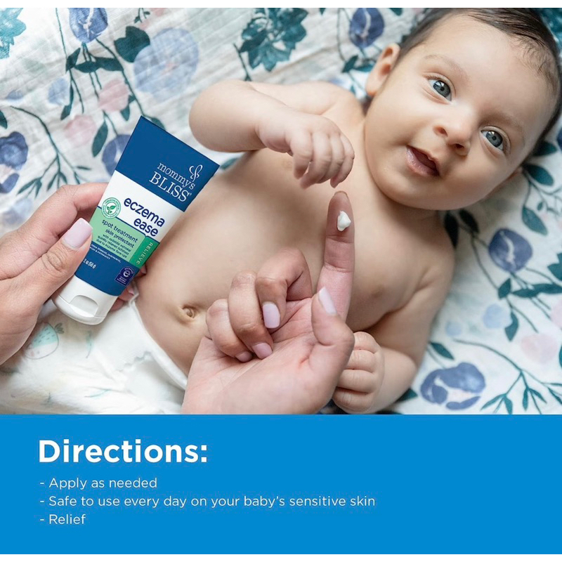 Kem dưỡng ẩm da chàm Mommy's Bliss® Eczema Ease Spot Treatment 56g dành cho bé từ 2 tuần tuổi của Mỹ