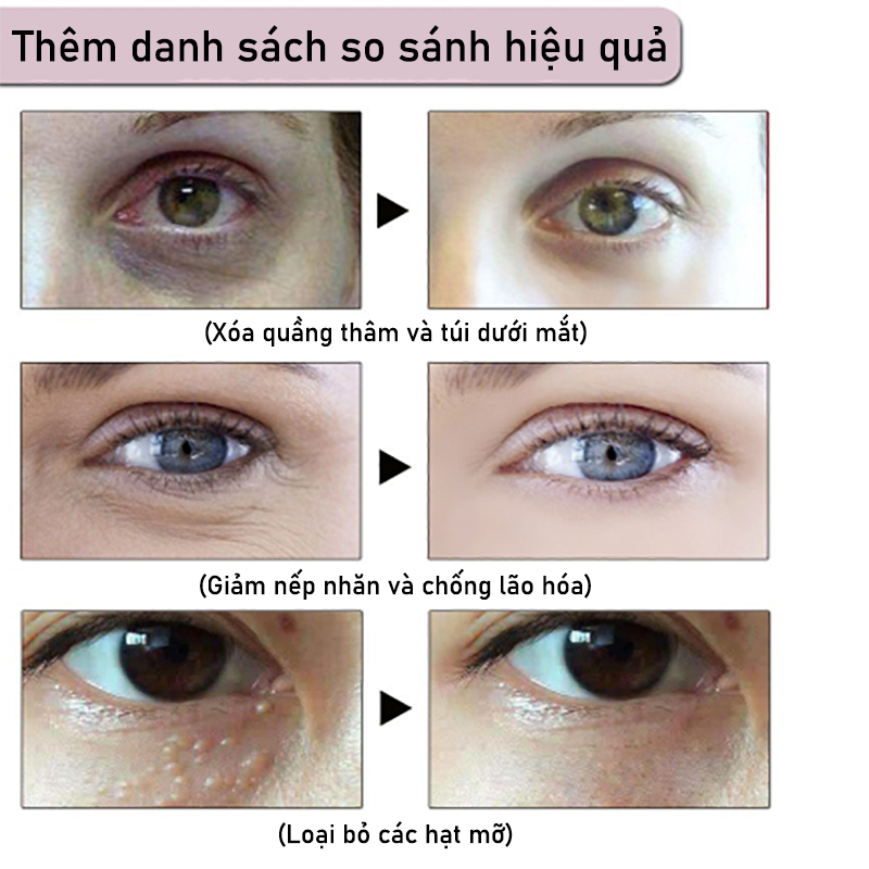 Kem nhăn mắt  kem xoá nhăn mắt  40g tinh chất chống lão loại bỏ các hạt mỡ loại bỏ quầng thâm