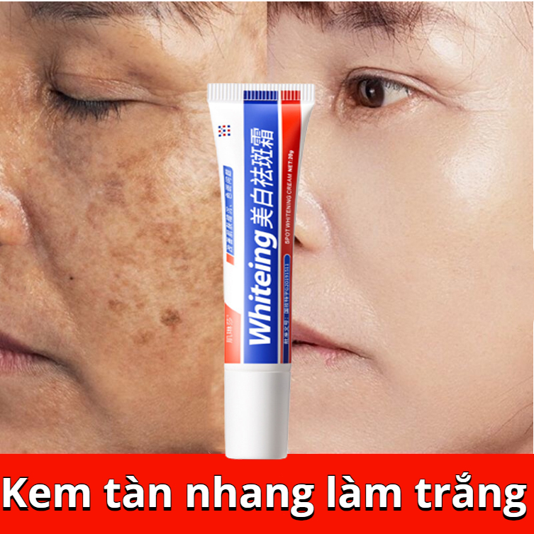 Kem tàn nhang Kem nám Làm trắng Loại bỏ hiệu quả tàn nhang đồi mồi tẩy mụn xóa nám Làm sáng màu da Dưỡng ẩm