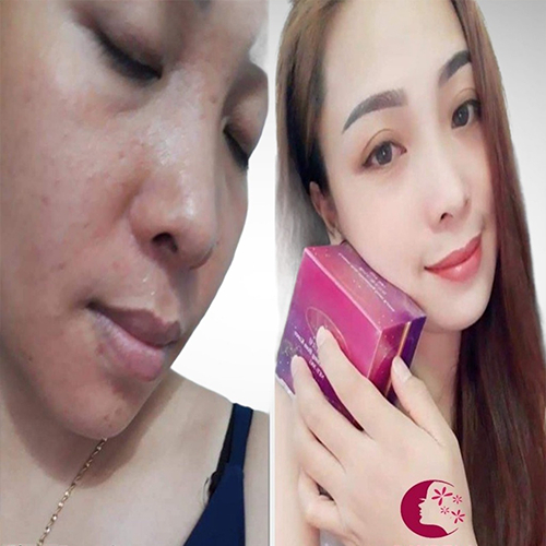 KEM TRẮNG DA CAO CẤP BAYBELA